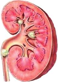 Kidney Stone